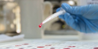 实验室工作人员拿着试管来确定血型和Rh因子