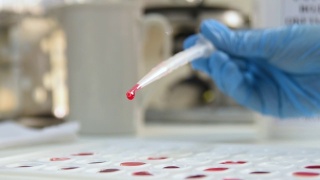 实验室工作人员拿着试管来确定血型和Rh因子视频素材模板下载