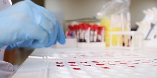 血型及RH因子检测
