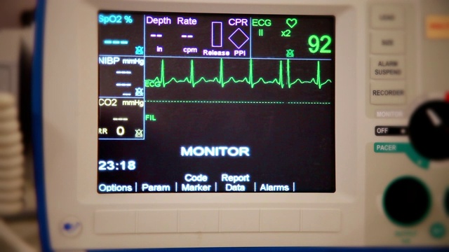 从患者心脏监护仪的角度拍摄的真实照片显示正常的窦性节律