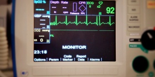从患者心脏监护仪的角度拍摄的真实照片显示正常的窦性节律