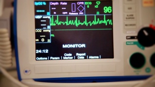 从病人的角度拍摄心脏病发作(心房纤颤)的真实照片视频素材模板下载