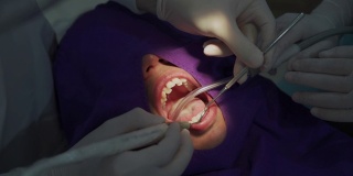 牙科医生清洁口腔内的牙垢
