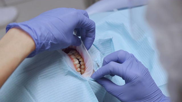 特写的牙医的手在蓝色手套治疗妇女的牙齿戴保护在牙科诊所。保健和医学的概念。