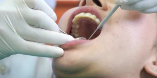 牙科病人在牙科诊所检查牙齿的妇女。UHD