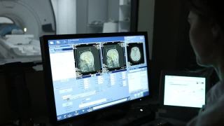 核磁共振，CT，医生看着监视器视频素材模板下载