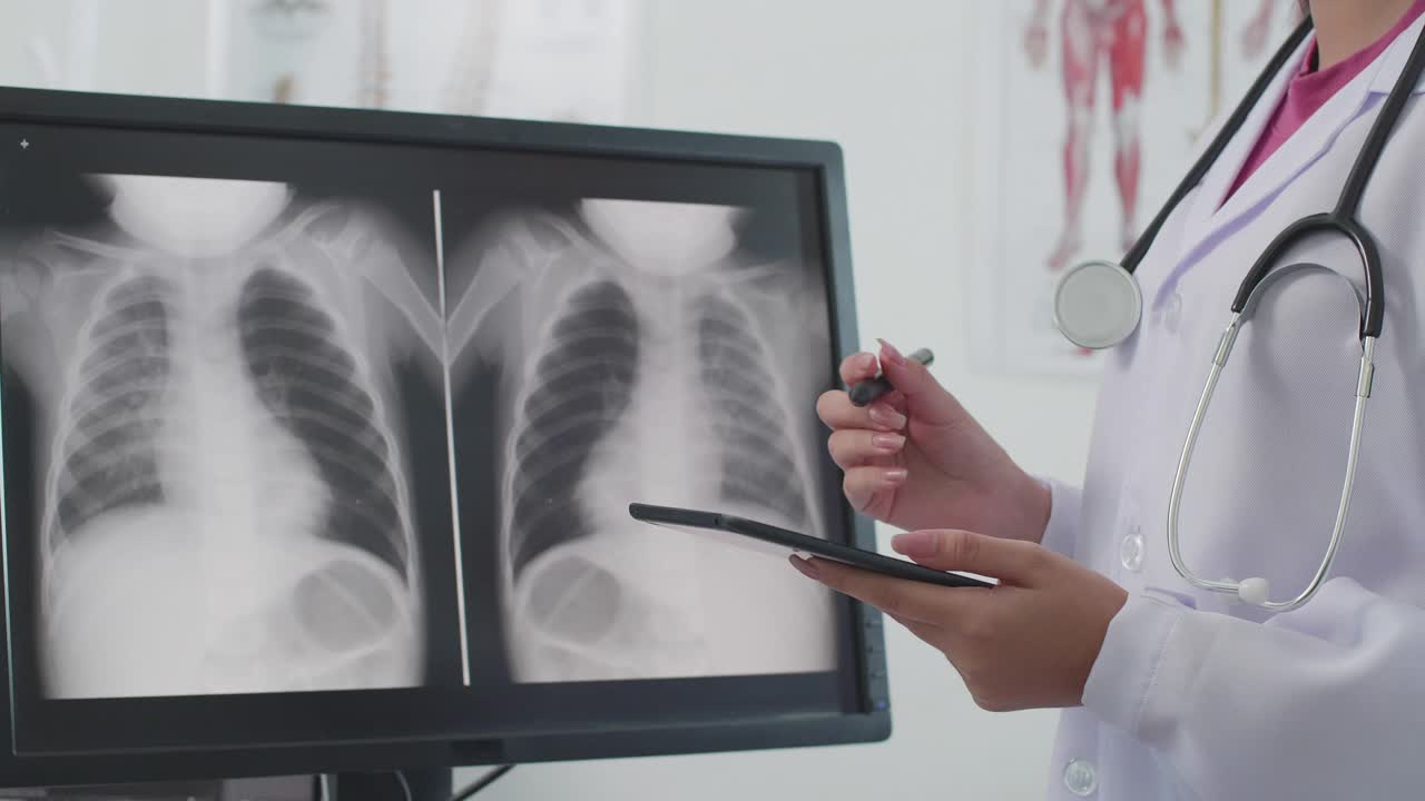 亚洲女性医生的手使用数字平板分析x射线图像