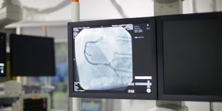 心脏手术期间放射学的监视器屏幕