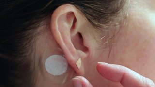 妇女在耳鸣问题上对针刺磁铁施加压力视频素材模板下载