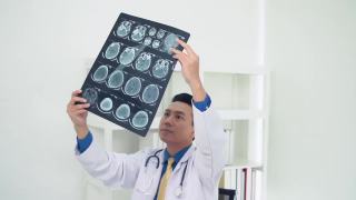医生对脑部进行了电脑断层扫描并进行了x光检查视频素材模板下载