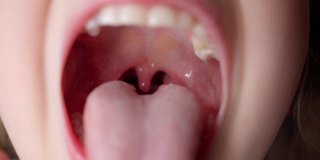 女孩张大嘴巴，伸出长长的舌头。孩子露出柔软的牙齿