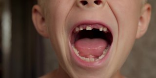 一个小男孩的特写镜头显示了他脱落的乳牙。