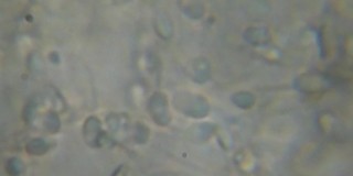 在相差显微镜下移动人类精子。精子(精子)在显微镜下观察。近距离显示精子。人类精液的视频。宏观的特写镜头。医学科学实验室。