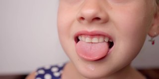 女孩张大嘴巴，伸出长长的舌头。孩子露出了他的牙齿