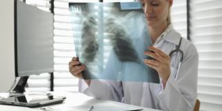 医生检查和观察MRI肺部x线图像
