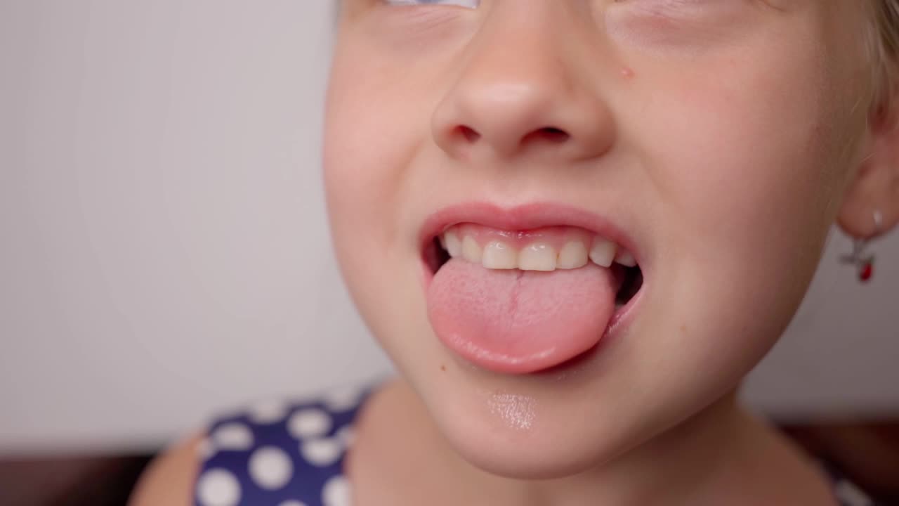 女孩张大嘴巴，伸出长长的舌头。孩子露出了他的牙齿
