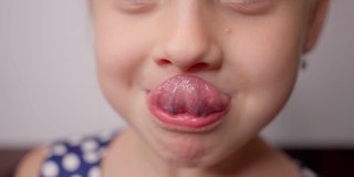 小女孩试着用舌头去够鼻子，进行言语治疗练习
