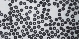 在医生团队的背景电脑显示器屏幕上显微镜下的病毒照片的特写。科学家在实验室讨论冠状病毒