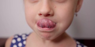 小女孩试着用舌头去够鼻子，进行言语治疗练习