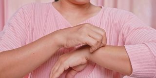 恼怒的中年妇女抓挠她的手瘙痒干燥皮肤，湿疹，皮炎，过敏，牛皮癣。保健和皮肤病的概念。