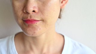 亚洲女性使用保湿霜治疗和改善她老化的皮肤。视频素材模板下载