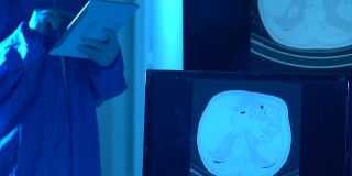 放射科门诊放射科医生检查患者胸部CT影像的高清视频