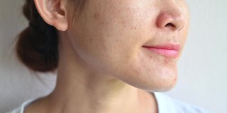 亚洲女性使用保湿霜治疗和改善她老化的皮肤。