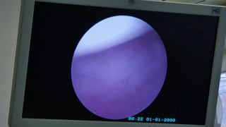 女性子宫颈部子宫子宫颈监测妇科检查。视频素材模板下载