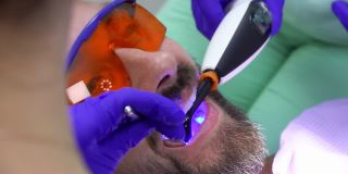 牙医正在用紫外线灯做牙齿修复手术