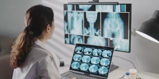医生工作与X射线图像计算机