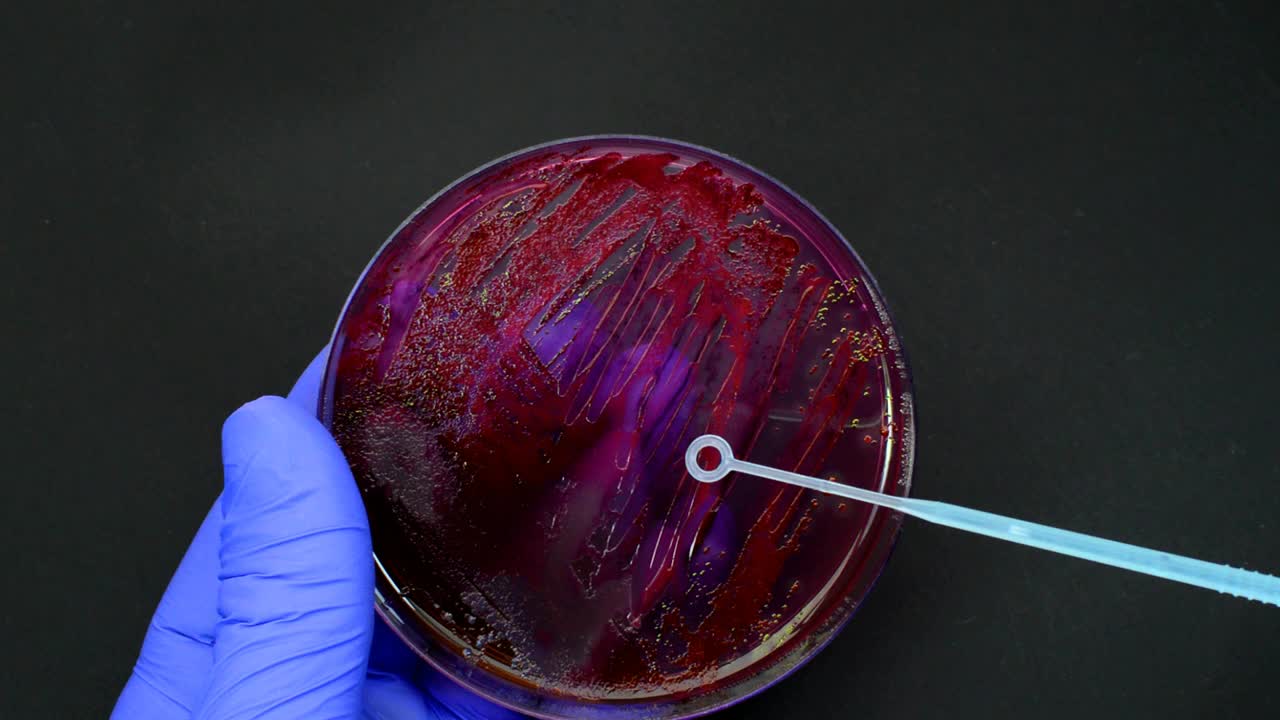 科学家将细菌菌落用一次性循环培养在培养基中