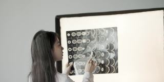 图为，一名亚洲女医生正在检查CT影像，并在光线下观察自己的身体状况