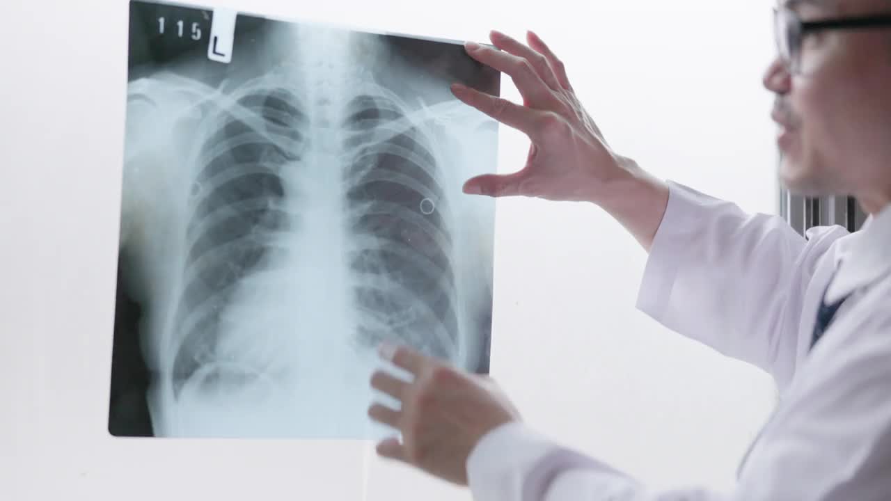 在医院的放射科，一名成熟的男医生和一名年轻的女病人正在检查胸部x光片和肺部扫描。