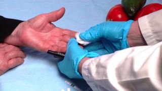 医生用针式血糖仪对糖尿病患者进行血糖测试，并检测其指尖血糖水平。糖尿病的医疗和治疗理念。视频素材模板下载