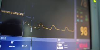心脏心电图和屏幕上的数字。在黑屏上，黄线以一定的心率移动。心电图波形线在监视器上的运动。特写镜头。