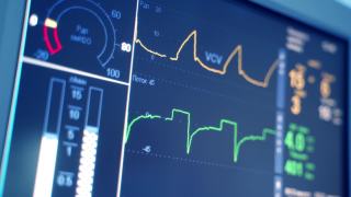 监测病人的生命体征，如心率。数字心脏监测器读出线图形和数字显示的病人被测量。特写镜头。视频素材模板下载