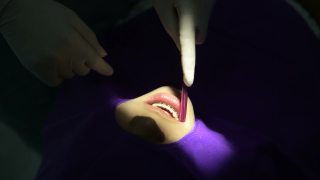 牙科医生正在给病人的牙齿动手术视频素材模板下载