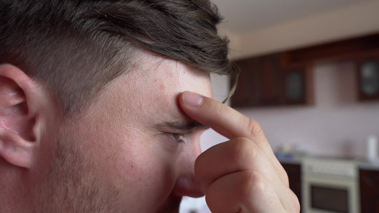 特写镜头。男人的手指碰了碰额头上的痘痘，仍然很不高兴。面部皮肤问题