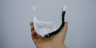 手握面部下颌骨内假体的金属3D打印机打印从生物ert钛合金近距离。颌面外科三维模型仿生植入物。下颌面部假体