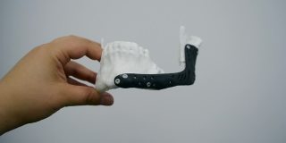 这个人手里拿着一个用3D打印机打印出来的假颌，假颌是用生物相容性材料和钛螺钉制成的。新型现代渐进增材3D打印技术
