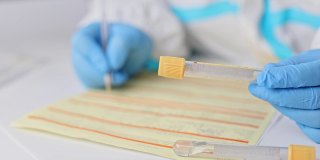 戴着医用手套的医生、护士或医疗技术人员手持试管进行血液检测，并为检测covid - 19和冠状病毒的患者填写表格。DNA PCR检测方案