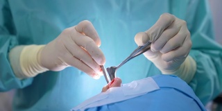 鼻外科手术鼻子的外科手术。外科医生在给病人做鼻部手术时使用无菌手术器械。特写镜头。