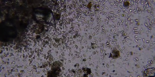 在光学显微镜下观察到的搅拌微生物
