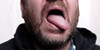 那人伸出舌头。检查舌头上的菌斑。胡子拉碴的男人。