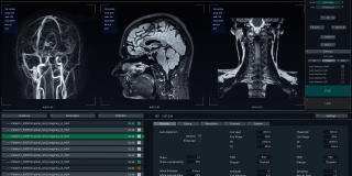 医学软件界面实时显示大脑磁共振图像扫描过程。真实的MRI有助于诊断神经系统疾病，肿瘤，损伤，中风，感染，头痛