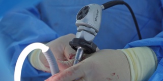 使用医疗设备进行手术的过程。外科医生带着手术设备在手术室里。