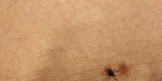 蜱是各种疾病的寄生载体