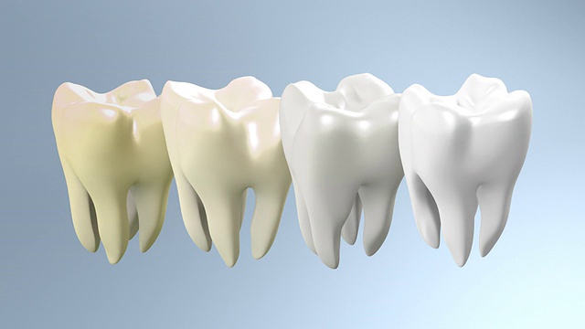 黄牙变白牙的过程
