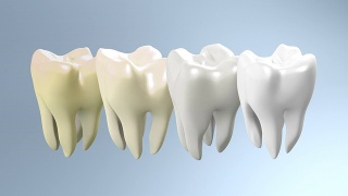 黄牙变白牙的过程视频素材模板下载