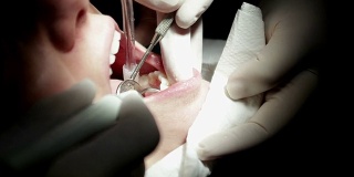 牙医在一个妇女的口腔内操作清洁和控制她的牙齿